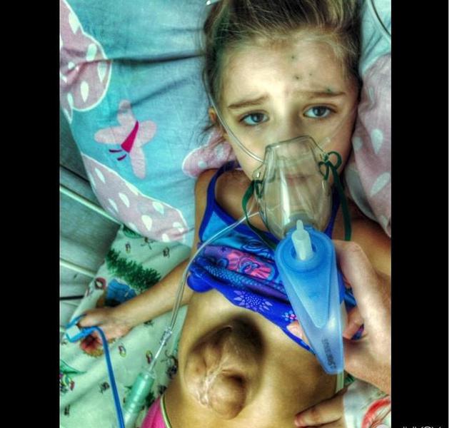 5岁小女孩患罕见“天使之心”疾病 心脏长于体外.4
