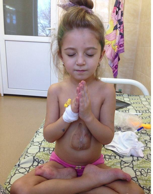 5岁小女孩患罕见“天使之心”疾病 心脏长于体外.6