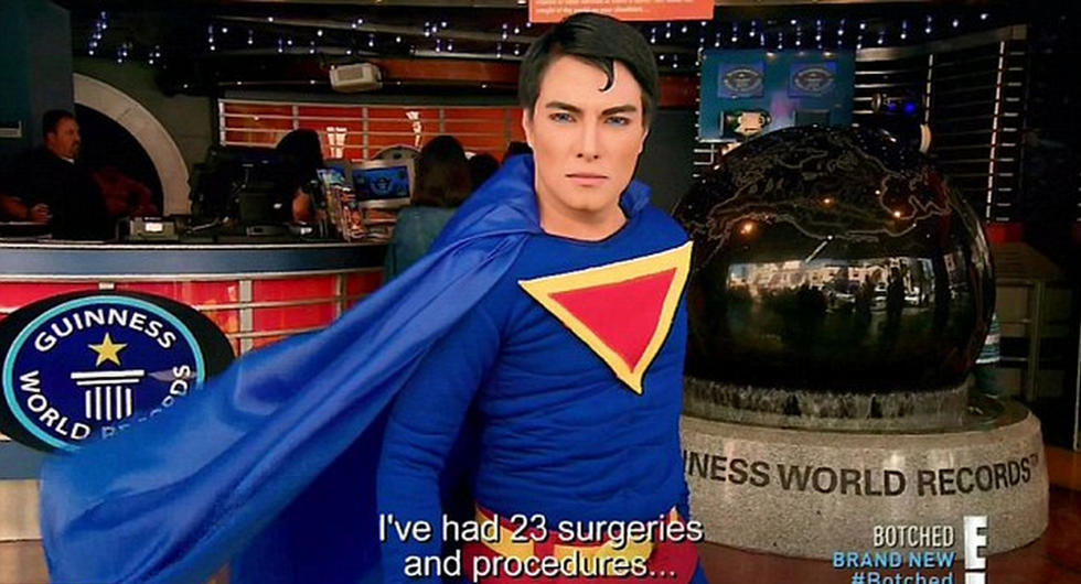 男子整容23次成现实版“超人-1”