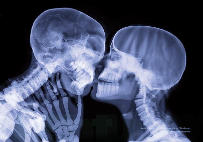 How romantic is kissing, really? Just crushing your skulls together.