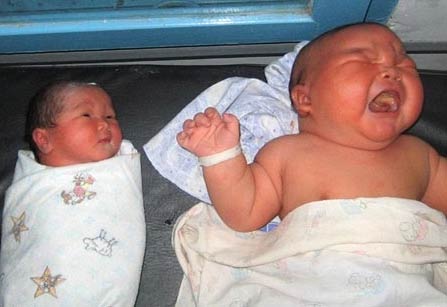 世界最重婴儿 出生时体重达18.16公斤