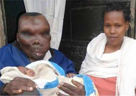 乌干达最丑男子“靠脸吃饭” 二婚8个孩子
