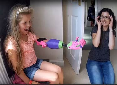 独臂女孩惊讶地收到3D打印手臂